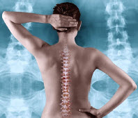 view of cervical curve on a person who is visiting a Chiropractor for Fibromyalgia